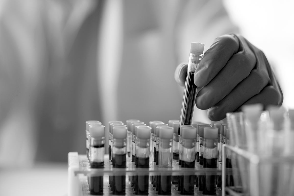 Visuel de l'article sur le lancement de BrainVasc